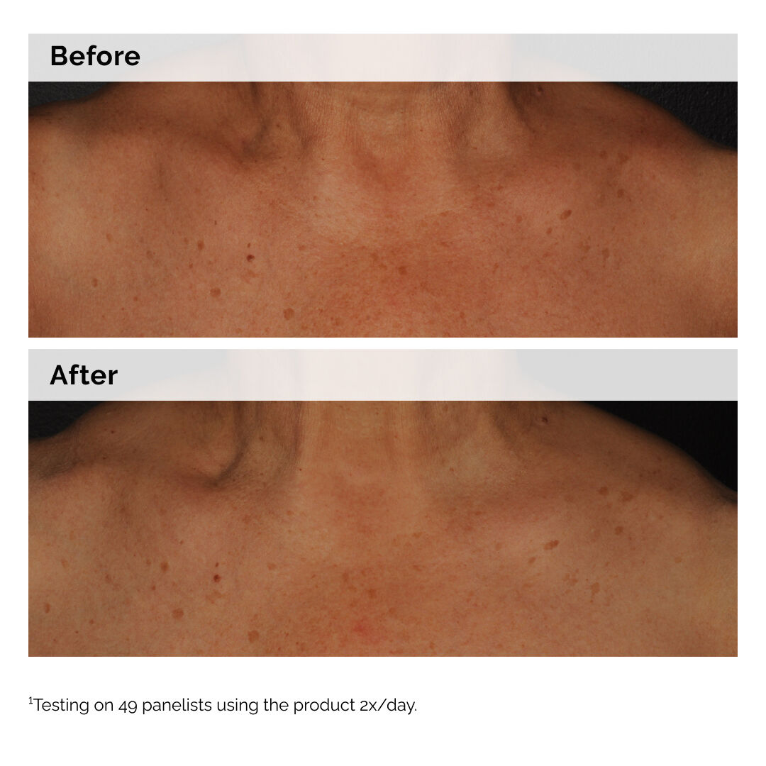 Alternative view of Niacinamide 5% Face and Body Emulsion